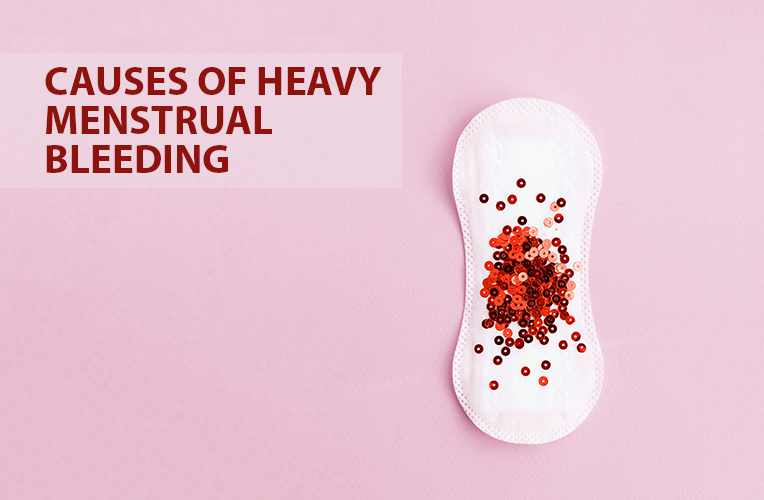 Is Heavy Bleeding Normal During Menstruation Fernandez Hospital 0124