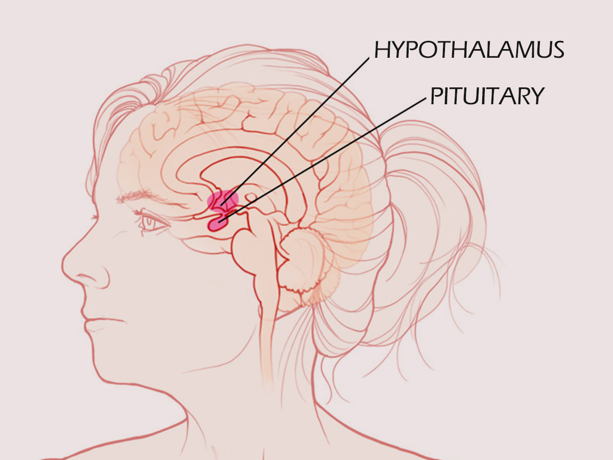 Гипофиз в голове. Гипоталамический синдром мрт. Опухоль гипофиза пролактинома. Головной мозг гипоталамус.