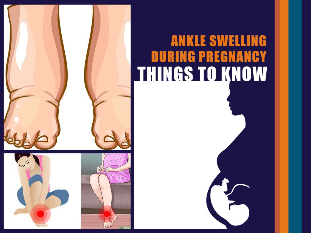 what-causes-swollen-feet